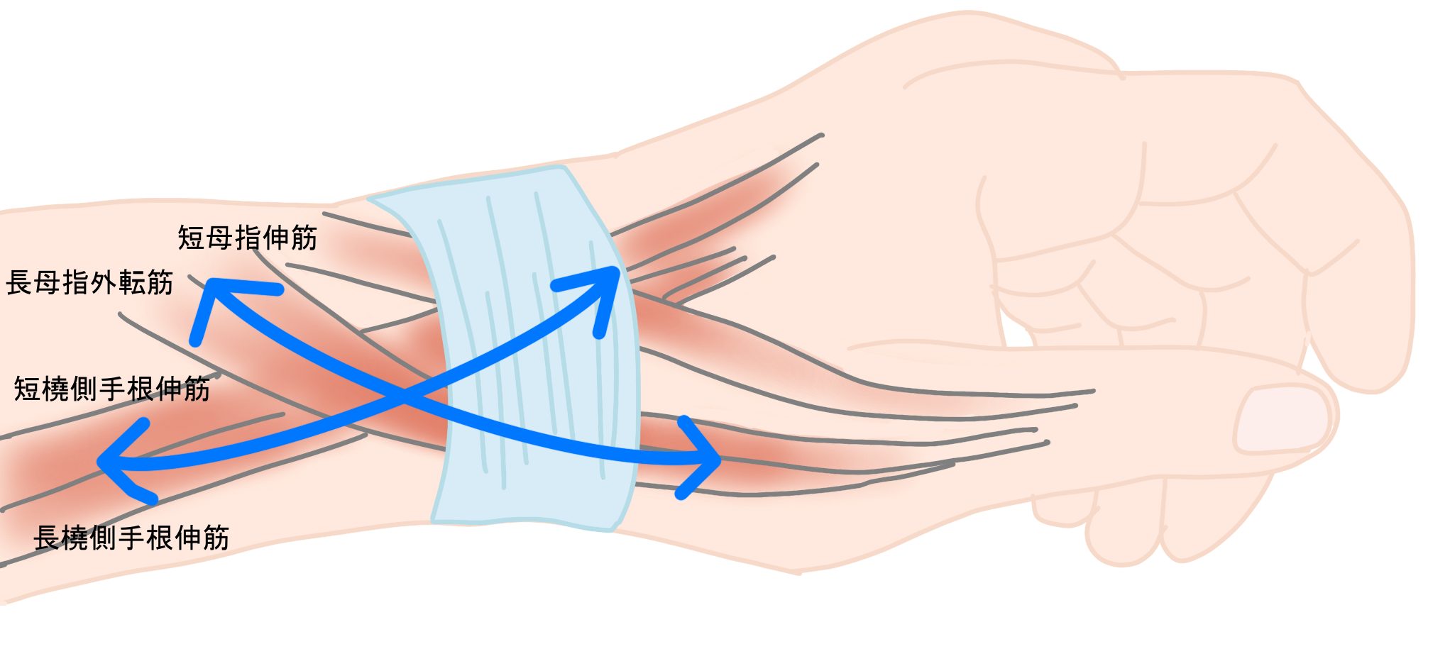手首の痛み 間庭整形外科 公式