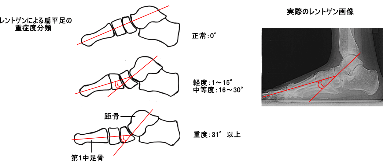 足の痛み 間庭整形外科 公式