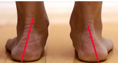足の痛み 間庭整形外科