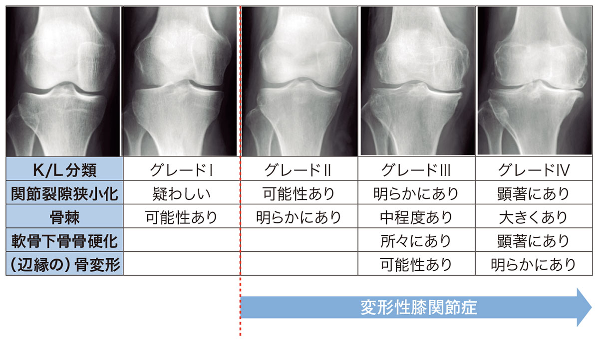 膝の痛み 間庭整形外科 公式