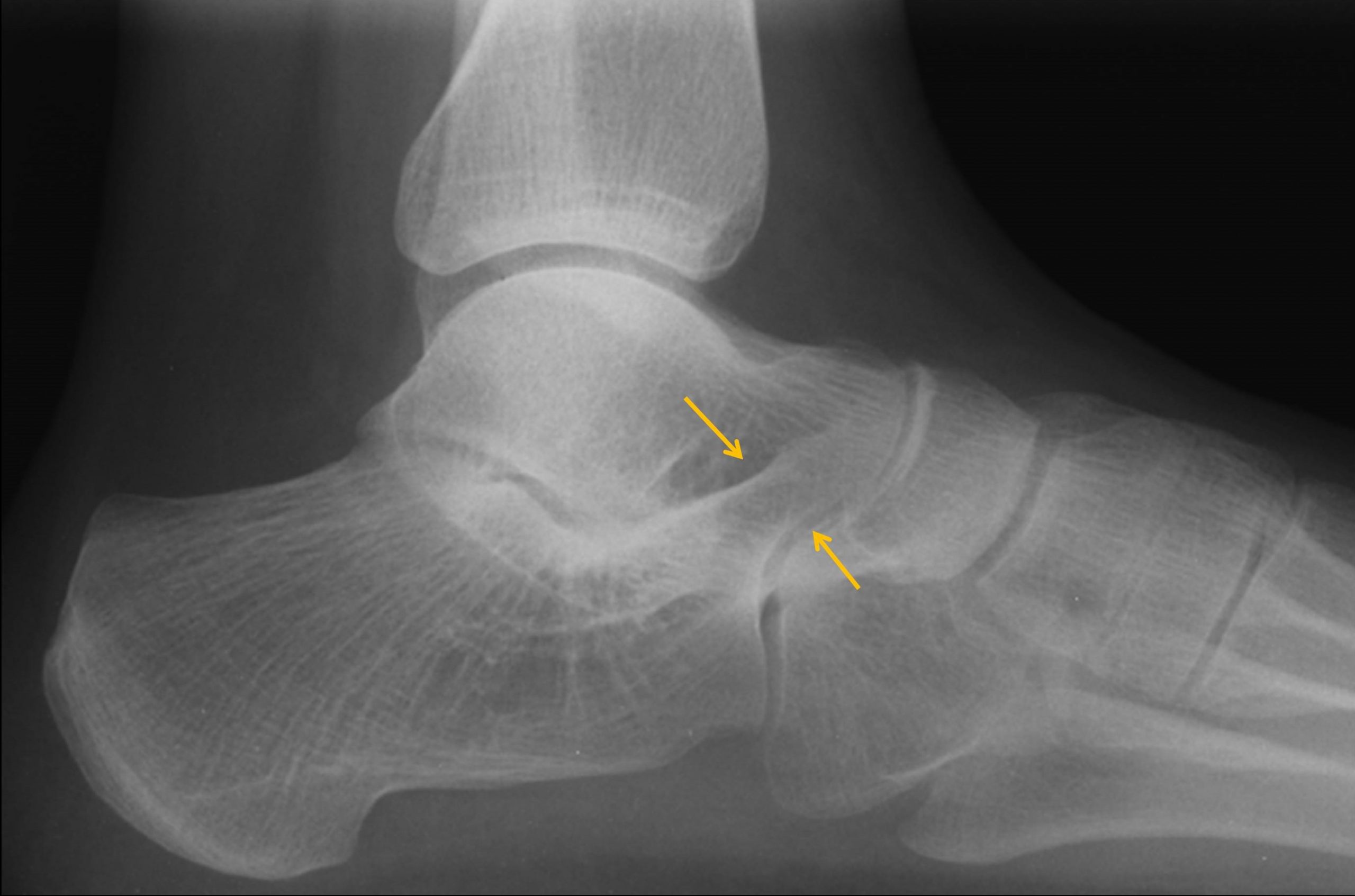 足の痛み 間庭整形外科 公式