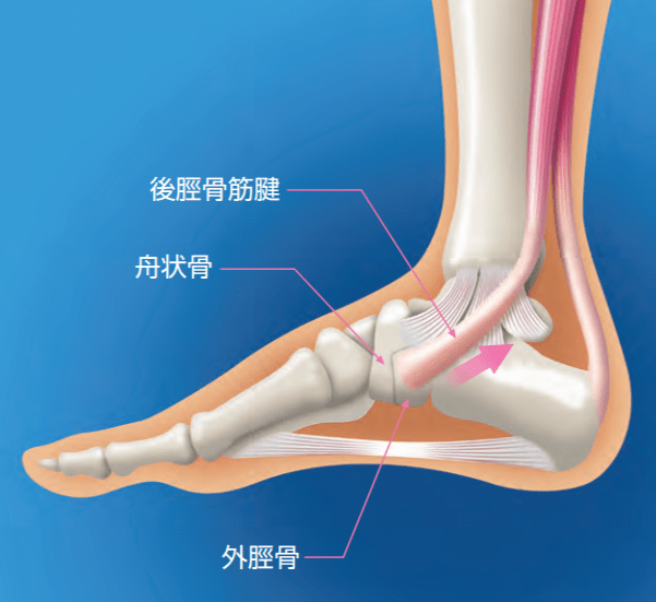 足の痛み | 間庭整形外科