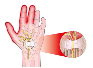 手や指の痛み 間庭整形外科